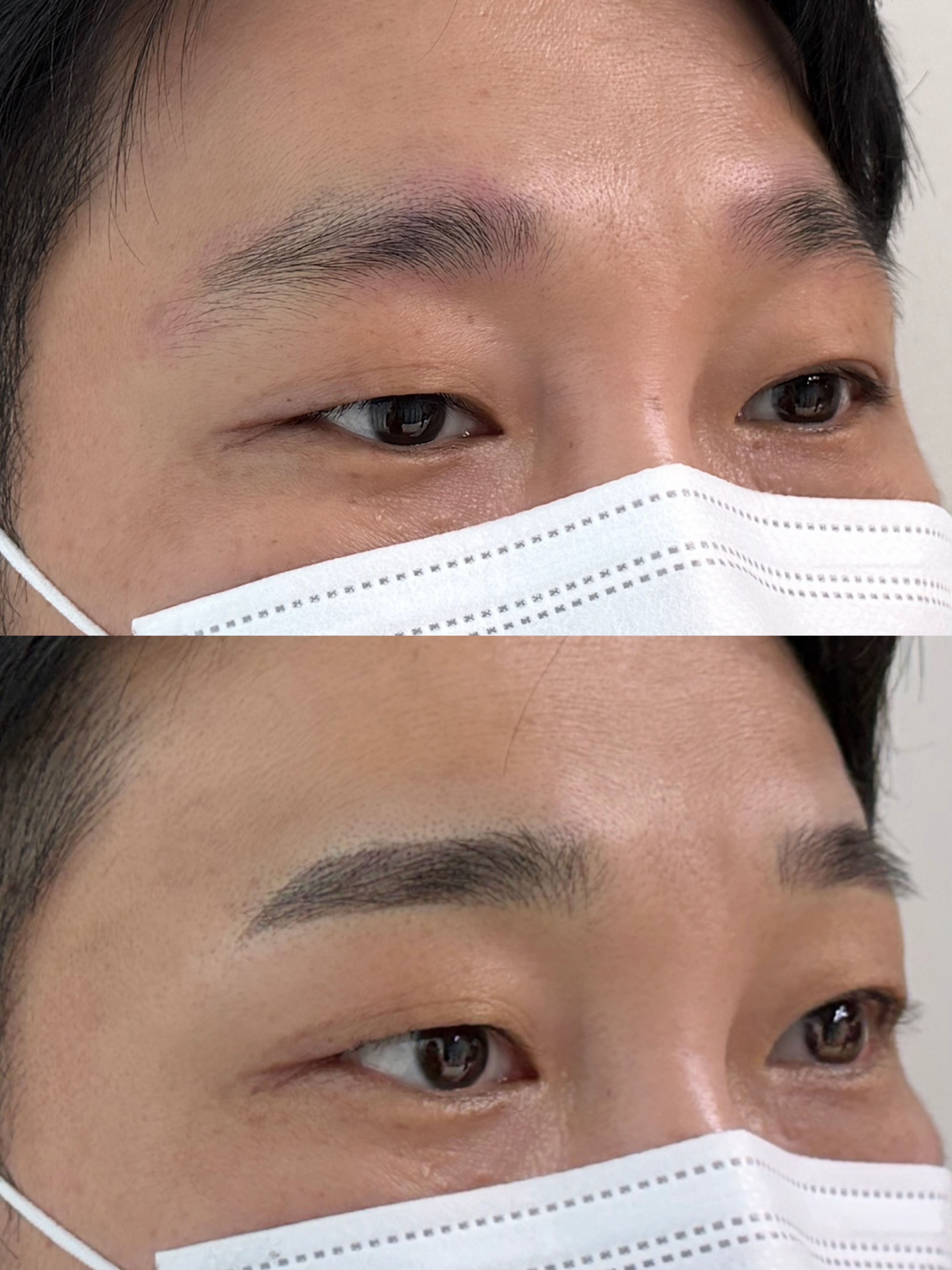 눈썹 문신 시술 사례 4